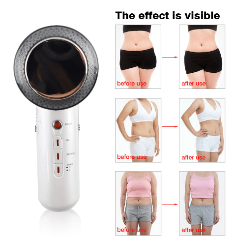 Ultrasonic Body Massager for Skin Firming & Relaxation | Noir OneEU 134419206b0a698561d2338299ad757aaUltrasonic Body Massager